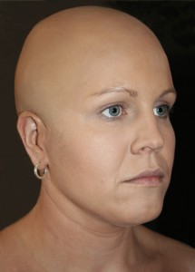 Emma-Bald-1